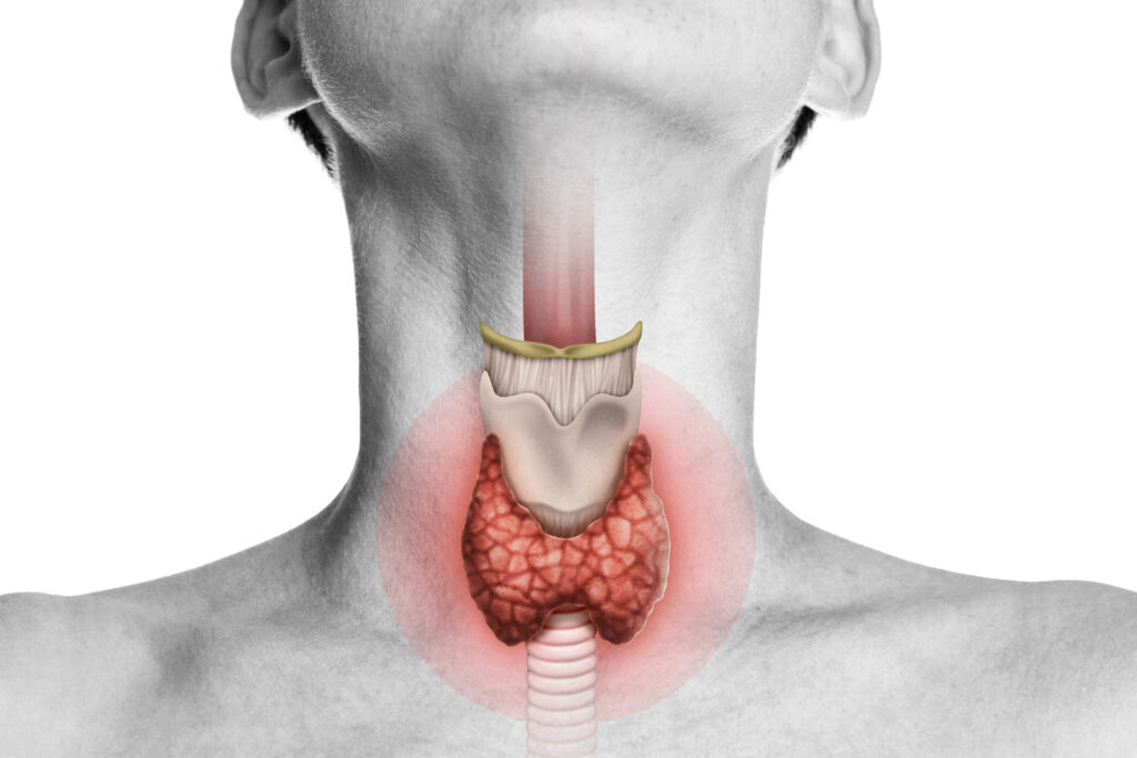 a person with a thyroid gland