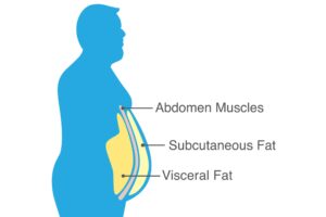 visceral fat illustration