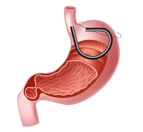 a diagram of a human stomach