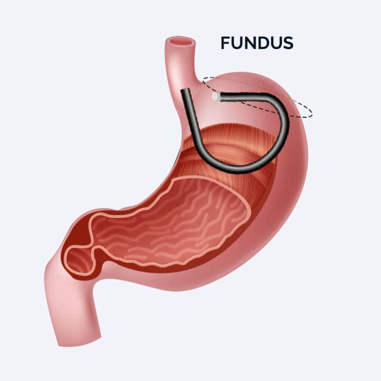 stomach and fundus