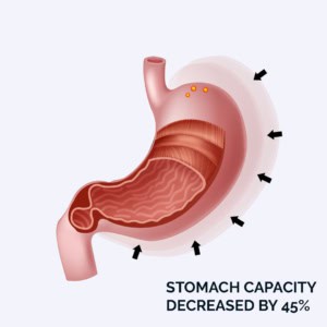 stomach