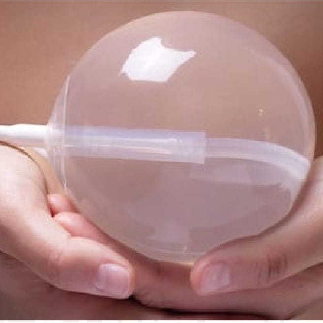 Gastric Balloon