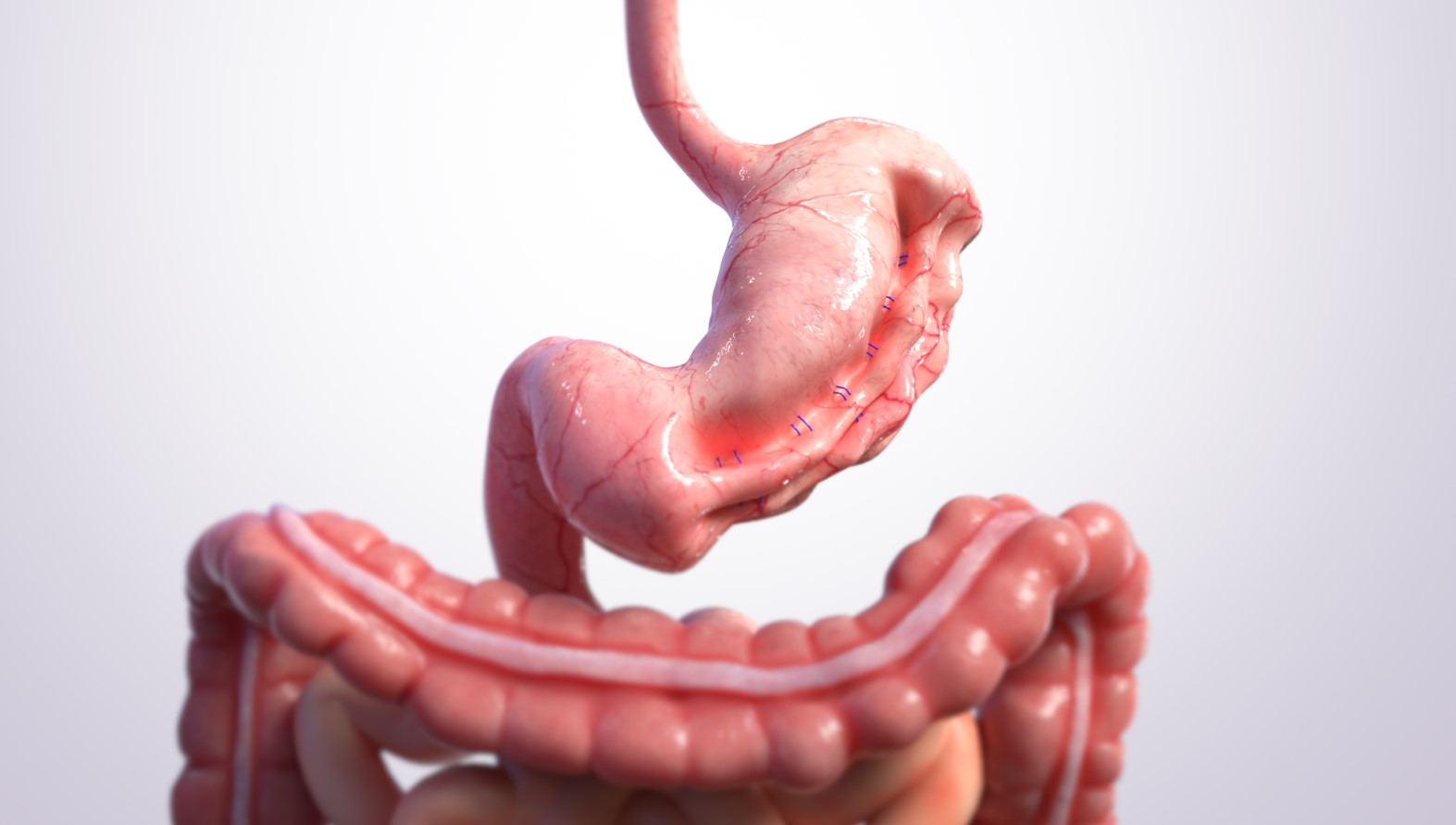 a human stomach with large intestine