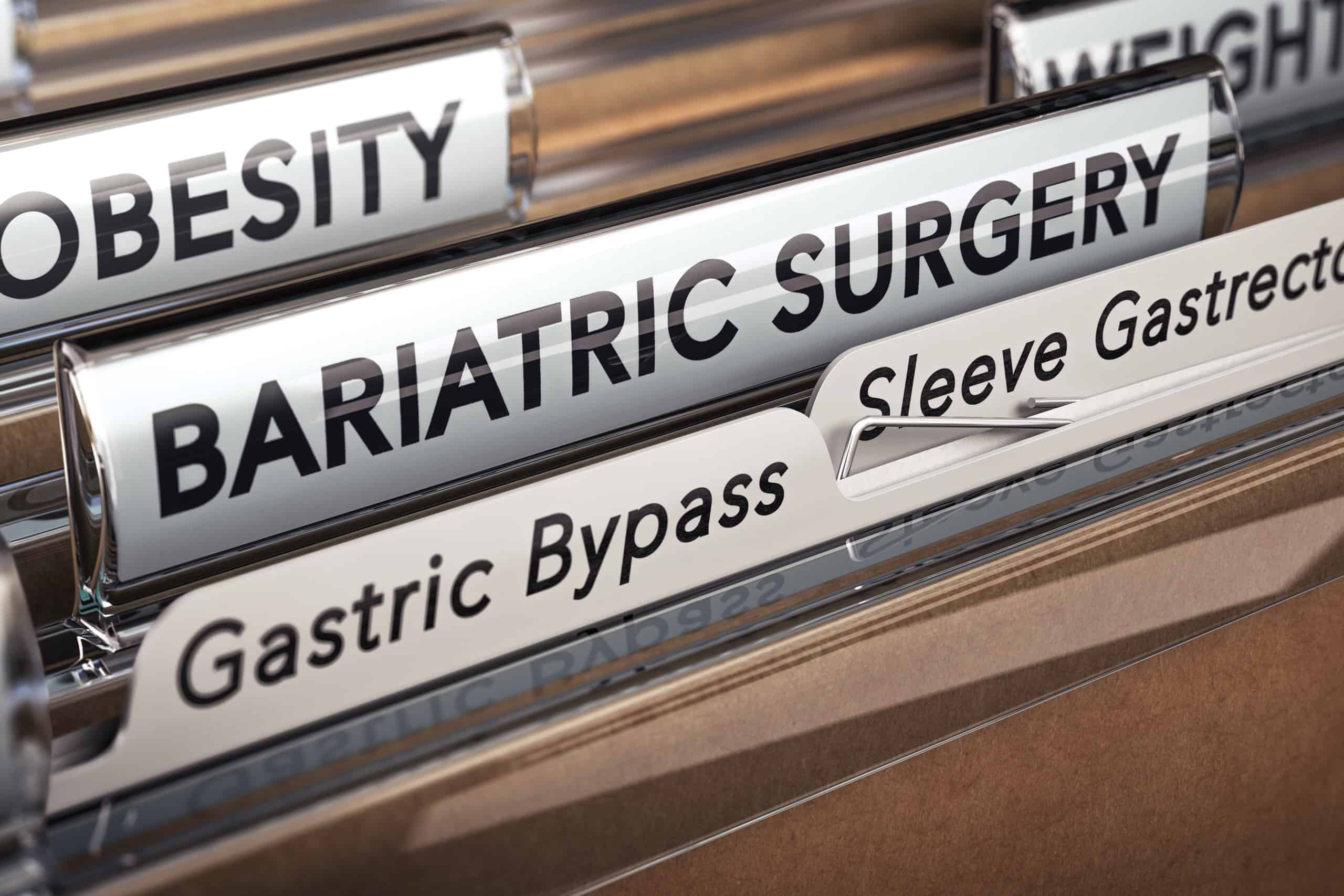 Gastric Sleeve vs. Gastric Bypass: Differences, Pros, Cons, Cost
